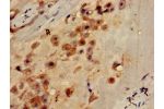 Immunohistochemistry of paraffin-embedded human placenta tissue using CSB-PA883623LA01HU at dilution of 1:100