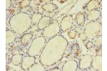 Immunohistochemistry of paraffin-embedded human thyroid tissue using CSB-PA883628LA01HU at dilution of 1:100