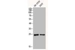 Western blot analysis of SH-SY5Y 293T using Dectin-2 antibody. Antibody was diluted at 1:1000. Secondary antibody  was diluted at 1:20000