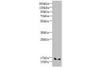 Western blot<br />
All lanes: FAM107B antibody at 8ug/ml+ Mouse heart tissue<br />
Goat polyclonal to rabbit at 1/10000 dilution<br />
Predicted band size: 16,35 kDa<br />
Observed band size: 16 kDa<br />