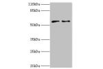 Western blot<br />
All lanes:CRISPLD2 antibody at 2ug/ml<br />
Lane 1:Jurkat cells<br />
Lane 2:CEM cells<br />
Secondary<br />
Goat polyclonal to rabbit at 1/10000 dilution<br />
Predicted band size: 56,52,43,18,14 kDa<br />
Observed band size: 56 kDa<br