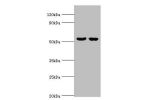 All lanes:Cytosolic beta-glucosidase antibody at 10ug/ml<br />
Lane 1:Hela whole cell lysate<br />
Lane 2:HepG2 whole cell lysate<br />
Secondary<br />
Goat polyclonal to rabbit at 1/10000 dilution<br />
Predicted band size: 54,19 kDa<br />
Observed band 