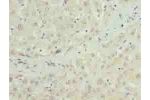 Immunohistochemistry of paraffin-embedded human liver tissue using CSB-PA884457LA01HU at dilution of 1:100