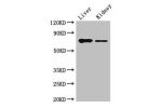 Western Blot<br />
Positive WB detected in:Mouse liver tissue,Mouse kidney tissue<br />
All lanes:DEF6 antibody at 4ug/ml<br />
Secondary<br />
Goat polyclonal to rabbit IgG at 1/50000 dilution<br />
Predicted band size: 74 kDa<br />
Observed band size: 7