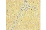 Immunohistochemistry of paraffin-embedded human liver tissue using CSB-PA884496LA01HU at dilution of 1:100