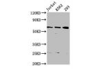 Western Blot<br />
Positive WB detected in:Jurkat whole cell lysate,K562 whole cell lysate,293 whole cell lysate<br />
All lanes:ELP3 antibody at 3.82