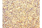 Immunohistochemistry of paraffin-embedded human spleen tissue using CSB-PA884503LA01HU at dilution of 1:100