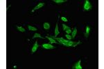 Immunofluorescent analysis of Hela cells using CSB-PA885677LA01HU at a dilution of 1:100 and Alexa Fluor 488-congugated AffiniPure Goat Anti-Rabbit IgG(H+L)
