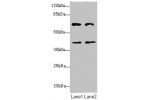 Western blot<br />
All lanes: DCP1A antibody at 3.79ug/ml<br />
Lane 1 : Jurkat whole cell lysate<br />
Lane 2 : HepG-2 whole cell lysate<br />
Secondary<br />
Goat polyclonal to Rabbit IgG at 1/10000 dilution<br />
Predicted band size: 64,60 kDa<br />
Ob