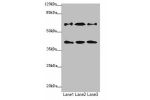 Western blot<br />
All lanes: DCP1A antibody at 1.23ug/ml<br />
Lane 1 : Jurkat whole cell lysate<br />
Lane 2 : 293T whole cell lysate<br />
Lane 3 : HepG-2 whole cell lysate<br />
Secondary<br />
Goat polyclonal to Rabbit IgG at 1/10000 dilution<br />
P