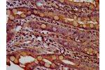 IHC image of CSB-PA885689LA01HU diluted at 1:600 and staining in paraffin-embedded human small intestine tissue performed on a Leica BondTM system. After dewaxing and hydration, antigen retrieval was mediated by high pressure in a citrate buffer (pH 6.0).