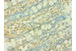 Immunohistochemistry of paraffin-embedded human rectum using CSB-PA885721ESR1HU at dilution 1:100