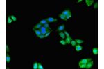 Immunofluorescent analysis of HepG2 cells using CSB-PA885723LA01HU at a dilution of 1:100 and Alexa Fluor 488-congugated AffiniPure Goat Anti-Rabbit IgG(H+L)