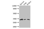 Western Blot<br />
Positive WB detected in:Mouse spleen tissue,Mouse lung tissue,Mouse kidney tissue<br />
All lanes: ALKBH4 antibody at 3ug/ml<br />
Secondary<br />
Goat polyclonal to rabbit IgG at 1/50000 dilution<br />
Predicted band size: 34,5 kDa<br 