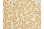 Immunohistochemistry of paraffin-embedded human liver tissue CSB-PA885789ESR1HU at dilution 1:100