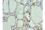 Immunohistochemistry of paraffin-embedded human thyroid tissue using CSB-PA885806LA01HU at dilution of 1:100