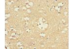 Immunohistochemistry of paraffin-embedded human brain tissue CSB-PA887022ESR1HU at dilution 1:100