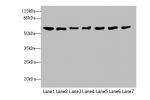 Western blot<br />
All lanes: CHRNA9 antibody at 0.75ug/ml<br />
Lane 1 : Mouse brain tissue<br />
Lane 2 : Jurkat whole cell lysate<br />
Lane 3 : Hela whole cell lysate<br />
Lane 4 : A549 whole cell lysate<br />
Lane 5 : A431 whole cell lysate<br />
La