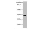 Western blot<br />
All lanes: CNTN4 antibody IgG at 2.22ug/ml+ Mouse kidney tissue<br />
Secondary<br />
Goat polyclonal to rabbit IgG at 1/10000 dilution<br />
Predicted band size: 34,21,12,17 kDa<br />
Observed band size: 33 kDa<br />