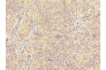 Immunohistochemistry of paraffin-embedded human tonsil tissue CSB-PA887023ESR2HU at dilution 1:100
