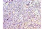 Immunohistochemistry of paraffin-embedded human tonsil using CSB-PA887120ESR1HU at dilution 1:100