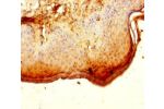 Immunohistochemistry of paraffin-embedded human skin tissue using CSB-PA887130LA01HU at dilution of 1:100