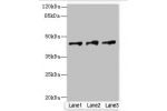 Western blot<br />
All lanes: DSCC1 antibody at 8ug/ml<br />
Lane 1 : CEM whole cell lysate<br />
Lane 2 : Hela whole cell lysate<br />
Lane 3 : A431 whole cell lysate<br />
Secondary<br />
Goat polyclonal to Rabbit IgG at 1/10000 dilution<br />
Predicted