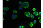 Immunofluorescent analysis of MCF-7 cells using CSB-PA887138LA01HU at a dilution of 1:100 and Alexa Fluor 488-congugated AffiniPure Goat Anti-Rabbit IgG(H+L)