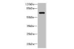 Western blot<br />
All lanes: DUSP16 antibody IgG at 1.69ug/ml+ 293T whole cell lysate<br />
Secondary<br />
Goat polyclonal to rabbit IgG at 1/10000 dilution<br />
Predicted band size: 74,17 kDa<br />
Observed band size: 73 kDa<br />