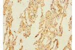 Immunohistochemistry of paraffin-embedded human lung tissue using CSB-PA887158ESR2HU at dilution 1:100