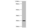 Western blot<br />
All lanes:FGFBP2 antibody at 2ug/ml+human serumSecondary<br />
Goat polyclonal to rabbit at 1/10000 dilution<br />
Predicted band size: 25kDa<br />
Observed band size: 25kDa<br />
