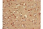 Immunohistochemistry of paraffin-embedded human brain tissue using CSB-PA887172LA01HU at dilution of 1:100