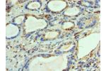 Immunohistochemistry of paraffin-embedded human prostate using CSB-PA887178ESR2HU at dilution 1:100