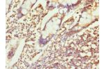 Immunohistochemistry of paraffin-embedded human small intestine using CSB-PA887976ESR1HU at dilution 1:100