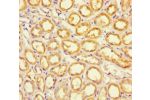 Immunohistochemistry of paraffin-embedded human kidney tissue using CSB-PA887991LA01HU at dilution of 1:100