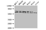 Western Blot<br />
Positive WB detected in:MCF-7 whole cell lysate,HEK293 whole cell lysate,K562 whole cell lysate,Mouse heart tissue,Mouse brain tissue,Mouse liver tissue<br />
All lanes:ACAD9 antibody at 1
