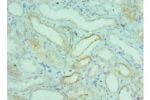 Immunohistochemistry of paraffin-embedded human kidney using CSB-PA888000ESR1HU at dilution 1:100