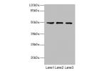 Western blot<br />
All lanes: