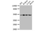 Western Blot<br />
Positive WB detected in:PC3 whole cell lysate,Mouse kidney tissue,Mouse liver tissue,Rat brain tissue<br />
All lanes:ACP6 antibody at 3