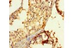 Immunohistochemistry of paraffin-embedded human testis tissue using CSB-PA889083LA01HU at dilution of 1:100