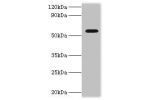 Western blot<br />
All lanes:ATP-dependent RNA helicase DDX19A antibody at 2ug/ml+mouse gonad tissue<br />
Secondary<br />
Goat polyclonal to rabbit at 1/10000 dilution<br />
Predicted band size: 54,44 kDa<br />
Observed band size: 54 kDa<br />