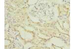 Immunohistochemistry of paraffin-embedded human kidney tissue using CSB-PA889119LA01HU at dilution of 1:100