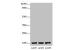 Western blot<br />
All lanes:FAIM antibody at 2ug/ml<br />
Lane 1:293T whole cell lysate<br />
Lane 2:rat gonad tissue<br />
Lane 3:jurkat whole cell lysate<br />
Secondary<br />
Goat polyclonal to rabbit at 1/10000 dilution<br />
Predicted band size: 21,