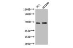 Western Blot<br />
Positive WB detected in:PC3 whole cell lysate,HEK293 whole cell lysate<br />
All lanes: ACTR10 antibody at 3ug/ml<br />
Secondary<br />
Goat polyclonal to rabbit IgG at 1/50000 dilution<br />
Predicted band size: 47 kDa<br />
Observed b