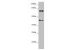 Western blot<br />
All lanes:CEP72 antibody at 3.37 ug/ml+ Hela whole cell lysate<br />
Secondary<br />
Goat polyclonal to rabbit IgG at 1/10000 dilution<br />
Predicted band size: 72,22 kDa<br />
Observed band size: 72,42 kDa<br />