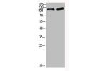 Western Blot analysis of 1,mouse-heart 3,mouse-brain cells using primary antibody diluted at 1:1000(4
