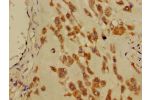 Immunohistochemistry of paraffin-embedded human placenta tissue using CSB-PA890663LA01HU at dilution of 1:100