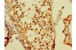 Immunohistochemistry of paraffin-embedded human testis tissue using CSB-PA890667LA01HU at dilution of 1:100