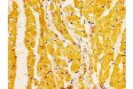 IHC image of CSB-PA890673LA01HU diluted at 1:200 and staining in paraffin-embedded human heart tissue performed on a Leica BondTM system. After dewaxing and hydration, antigen retrieval was mediated by high pressure in a citrate buffer (pH 6.0). Section w