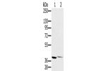 Gel: 8%SDS-PAGE, Lysate: 40 